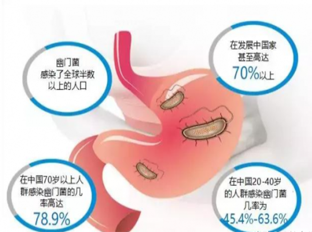 幽门螺杆菌感染概率
